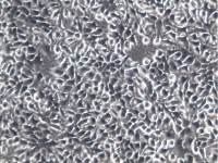人乳腺癌细胞MCF7-GFP