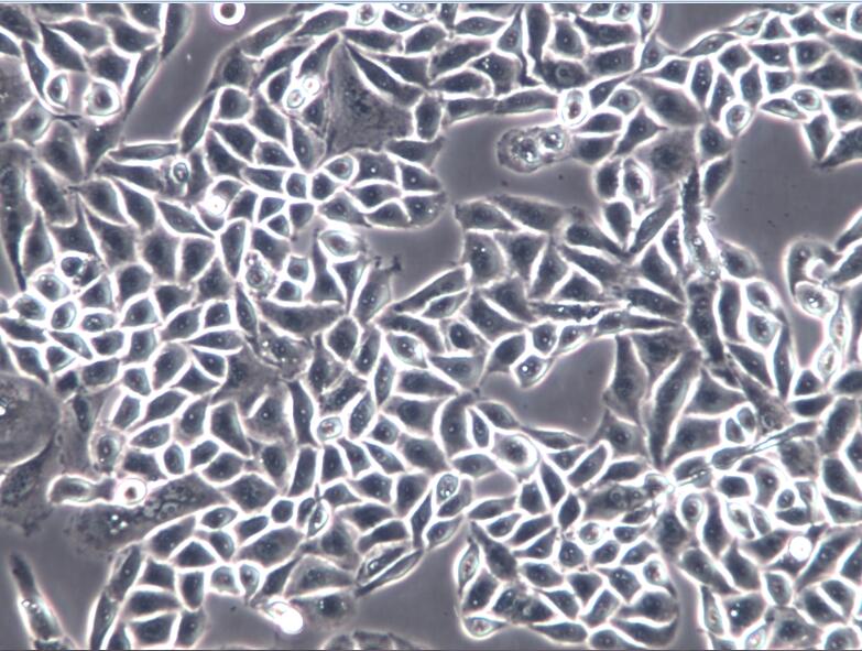 人肺癌细胞PC-9