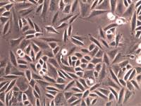 SiHa细胞、SiHa细胞、SiHa细胞