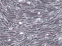 MRC5细胞 MRC-5细胞、MRC5细胞 MRC-5细胞