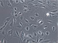 肝癌细胞SNU-387、肝癌细胞SNU-387、SNU-387细胞