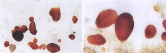 不仅是消毒，教你玩转碘液染色