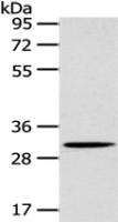 Anti-SLC25A20 antibody