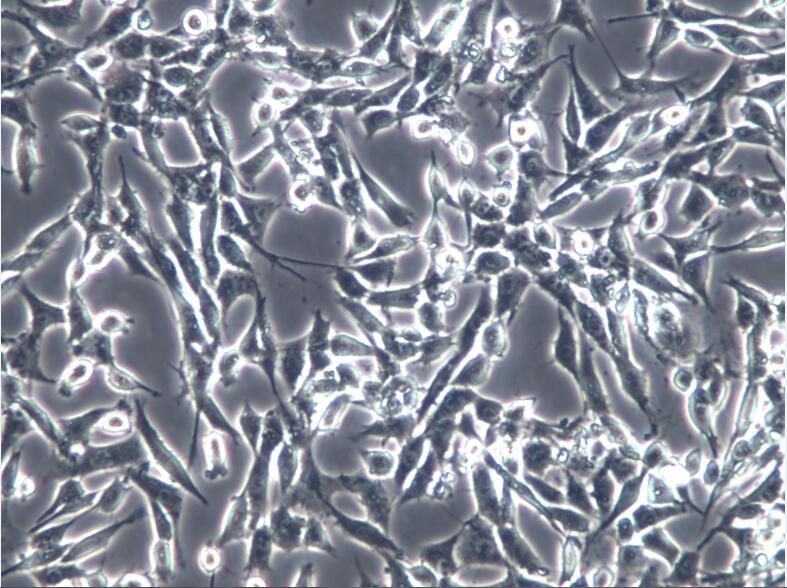 PA317逆转录病毒包被的NIH3T3细胞PA317逆转录病毒包被的NIH3T3细胞、PA317逆转录病毒包被的NIH3T3细胞