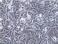 UM-UC-3膀胱移行细胞癌、UMUC3、UM-UC-3