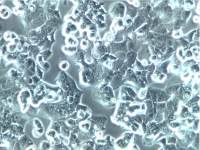 PLC/PRF/5细胞、PLC/PRF/5细胞、PLC/PRF/5细胞