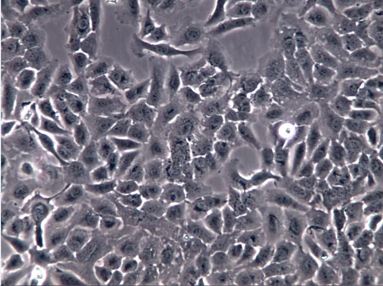SKOV3细胞、SK-OV-3细胞 SKOV3细胞
