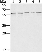 Anti-SESN1 antibody