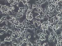 人前列腺细胞LNCaP