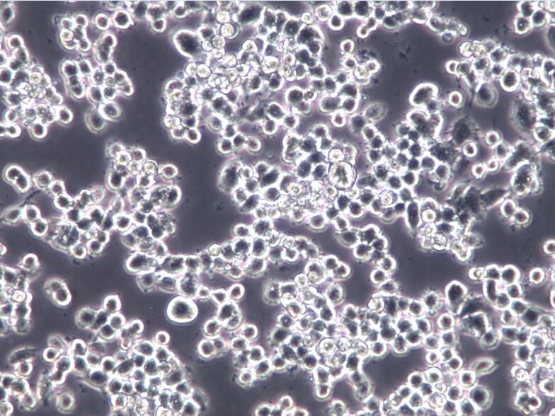 Neuro-2a小鼠脑神经瘤细胞Neuro2a[N2a]、Neuro2a[N2a]