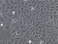 SU.86.86 人胰腺导管癌细胞