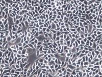 Anglne细胞 、Anglne细胞系、Anglne细胞株