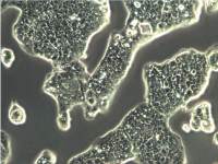 N87细胞、N87、NCI-N87细胞