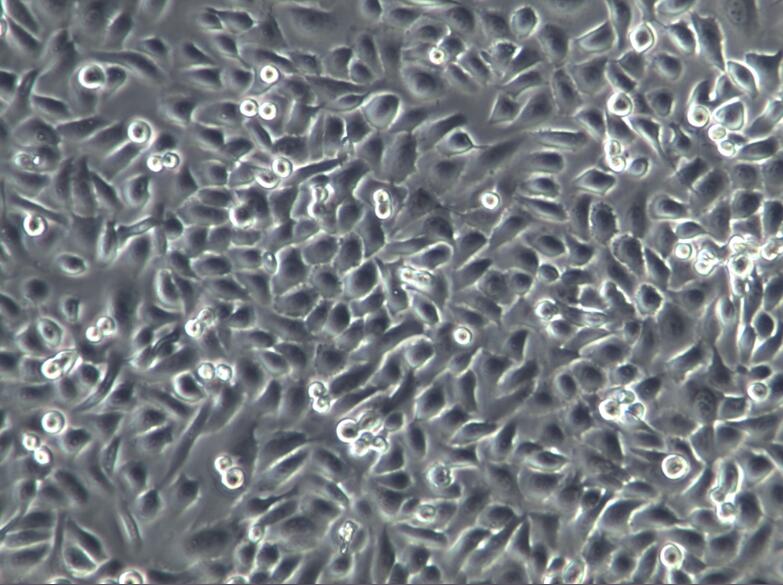 人子宫颈表皮癌细胞ME-180