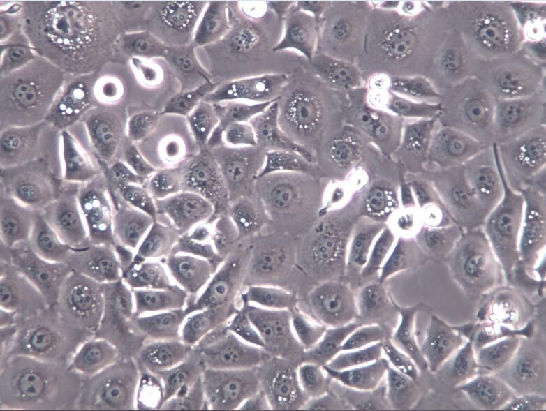 KYSE-140细胞、KYSE-140、KYSE-140细胞