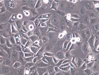 KYSE-140细胞、KYSE-140、KYSE-140细胞