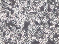 MC38细胞、MC38细胞、MC38细胞