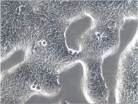 RT4 RT-4细胞 RT4细胞