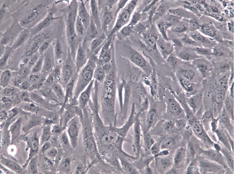 人软骨肉瘤细胞SW 1353