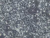 RL95-2细胞 RL952细胞、RL95-2细胞