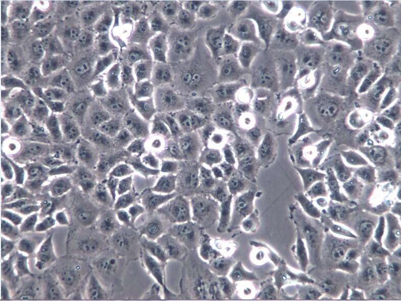 胰腺癌细胞PANC-1、PANC1细胞、PANC-1细胞