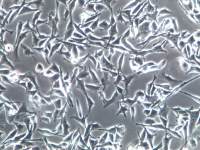 SKMEL28细胞、SK-MEL-28细胞、SK-MEL-28细胞