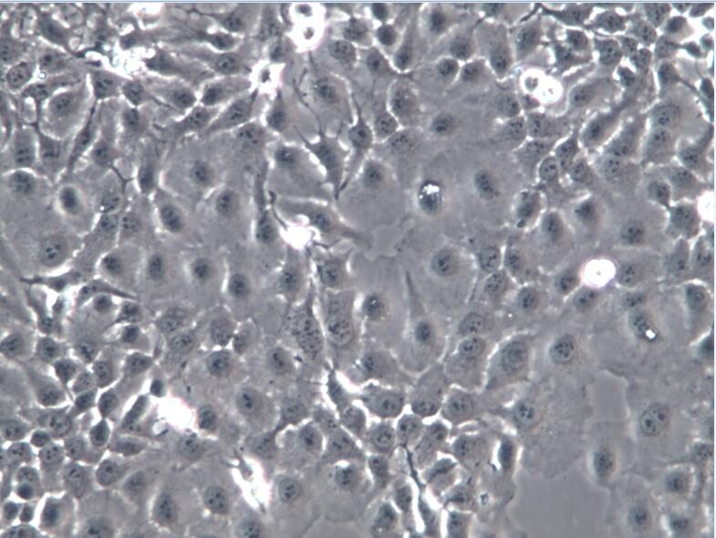 KYSE-150食管鳞癌细胞、KYSE150、KYSE150细胞