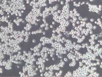 Sp2/0-Ag14小鼠骨髓瘤细胞Sp2/0-Ag14、Sp2/0-Ag14