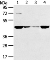 Anti-SMYD5 antibody