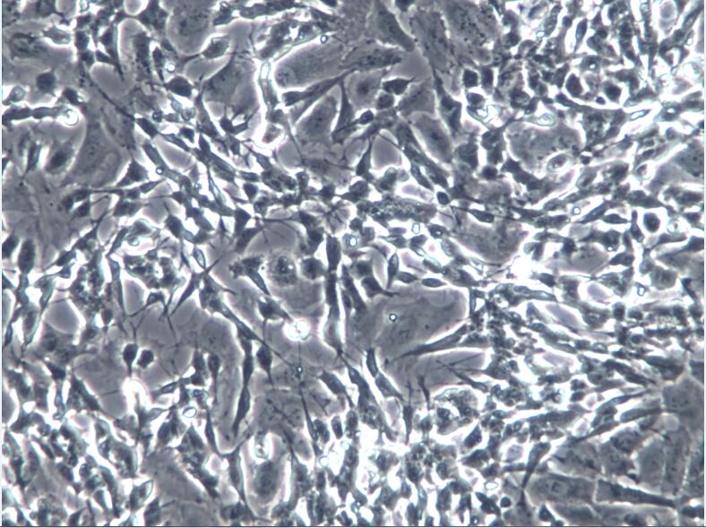 人神经母细胞瘤细胞SH-SY5Y