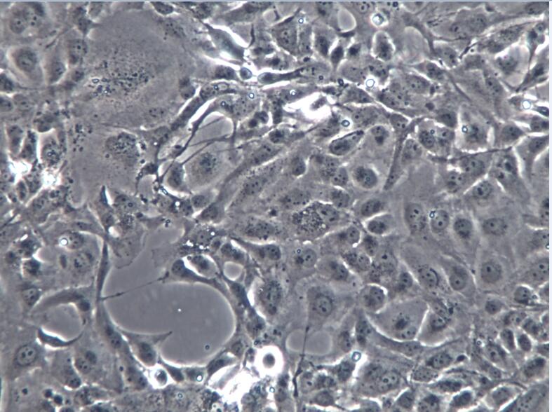 LX-2细胞、LX2细胞、LX2正常肝细胞