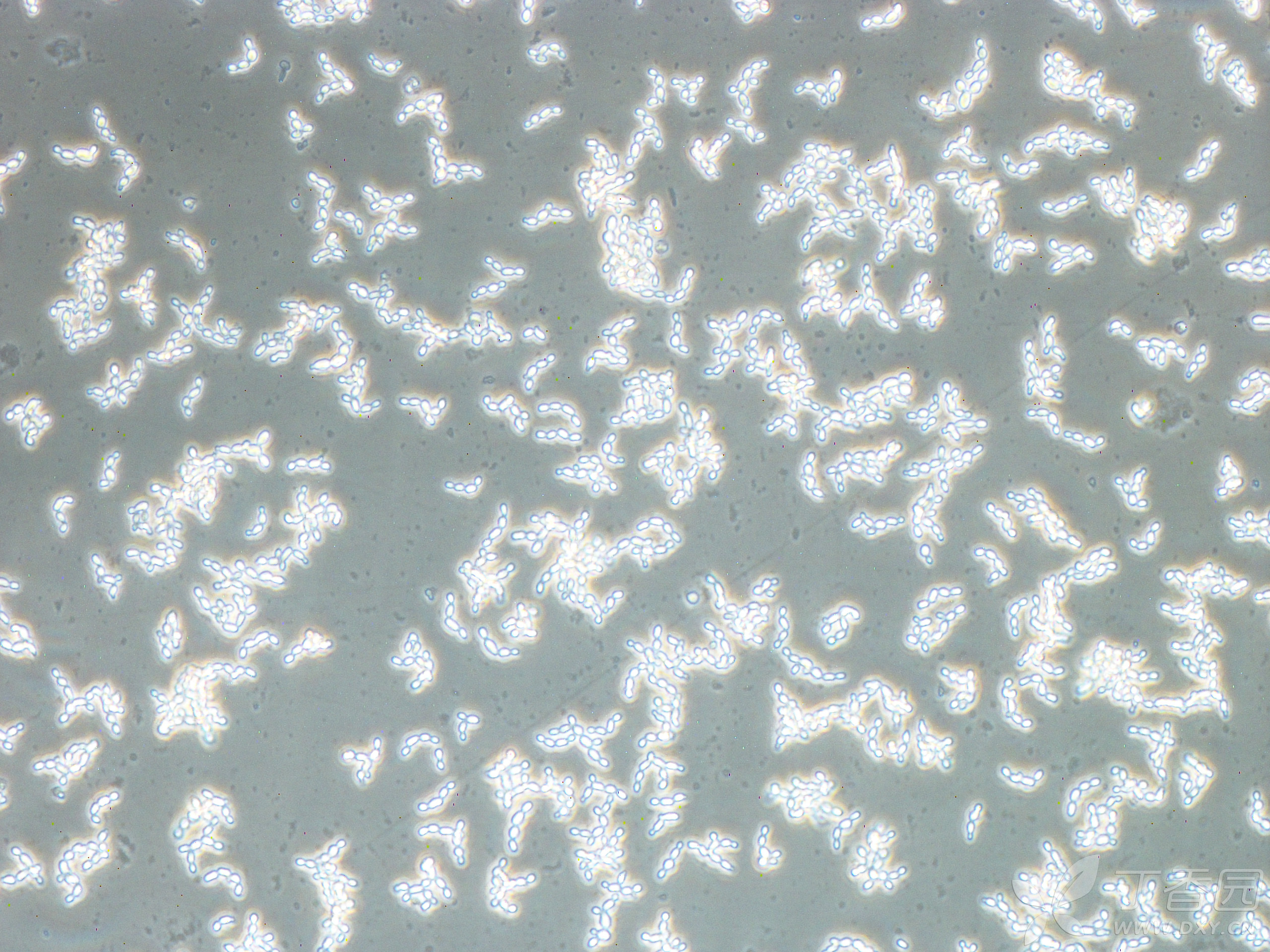 提小鼠脑星型胶质细胞,细胞污染如图片,这是什么情况