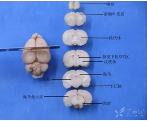 求助:小鼠脑部切片,要观察海马ca1区,下丘脑和皮质,可以在一个切面上