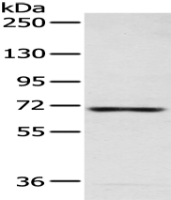 Anti-CAMKK2 antibody