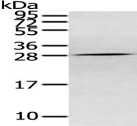 Anti-CLDN15 antibody