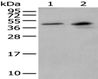 Anti-MAGEB1 antibody