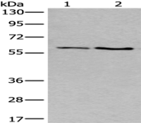 Anti-SLC17A8 antibody