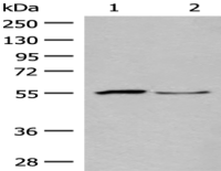 Anti-SLC2A8 antibody
