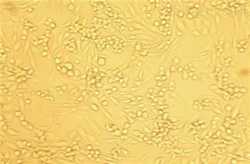 NCI-H205人肾上腺腺瘤细胞