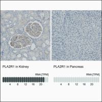 HPA012657 Anti-PLA2R1 antibody 
