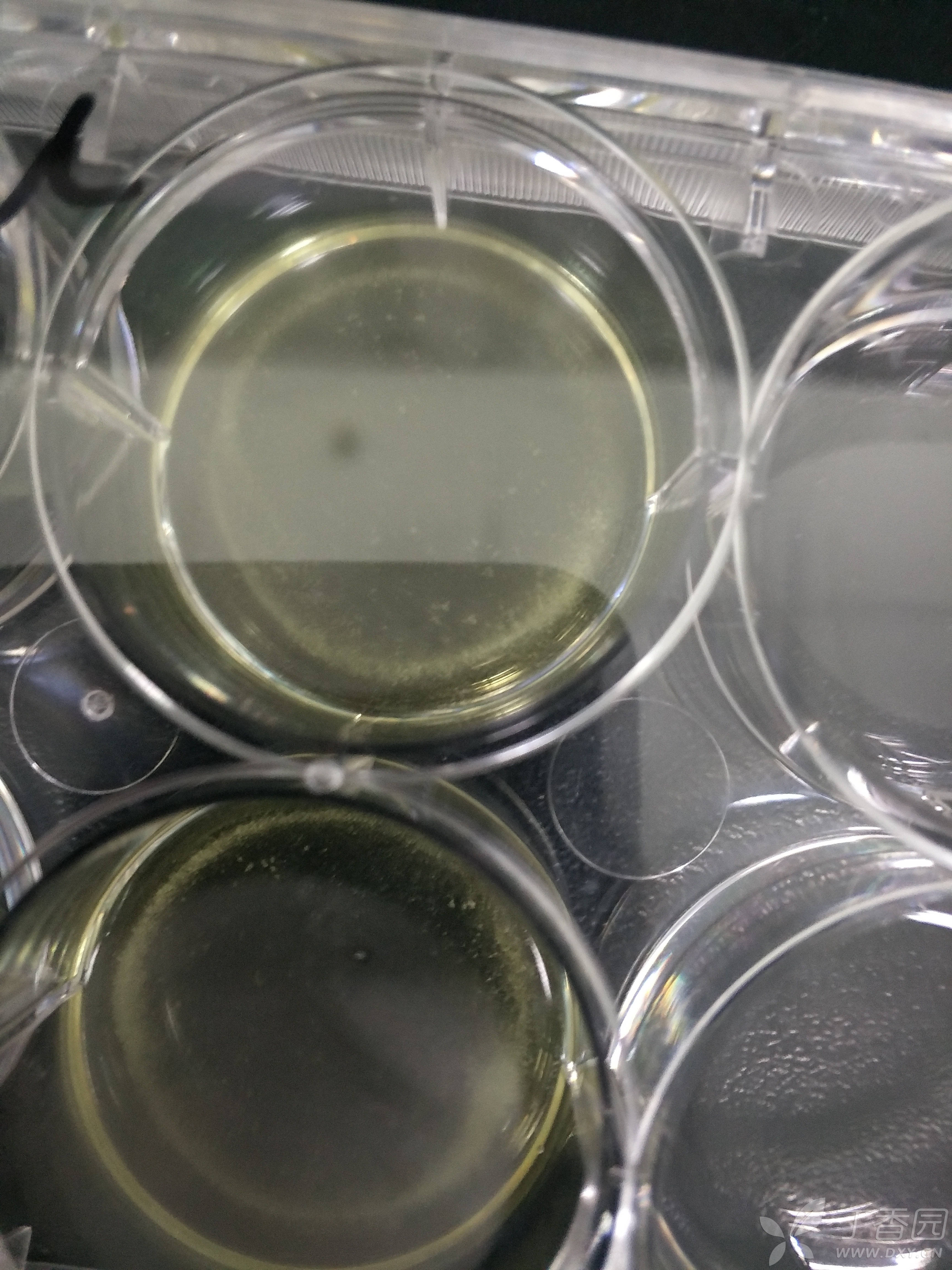 衰老β半乳糖苷酶染色