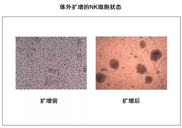 体外扩增的NK细胞状态