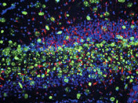 MAB353 Nestin 巢蛋白抗体