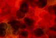 FDA 授予阿斯利康嗜酸性粒细胞增多症药物 Fasenra 孤儿药资格
