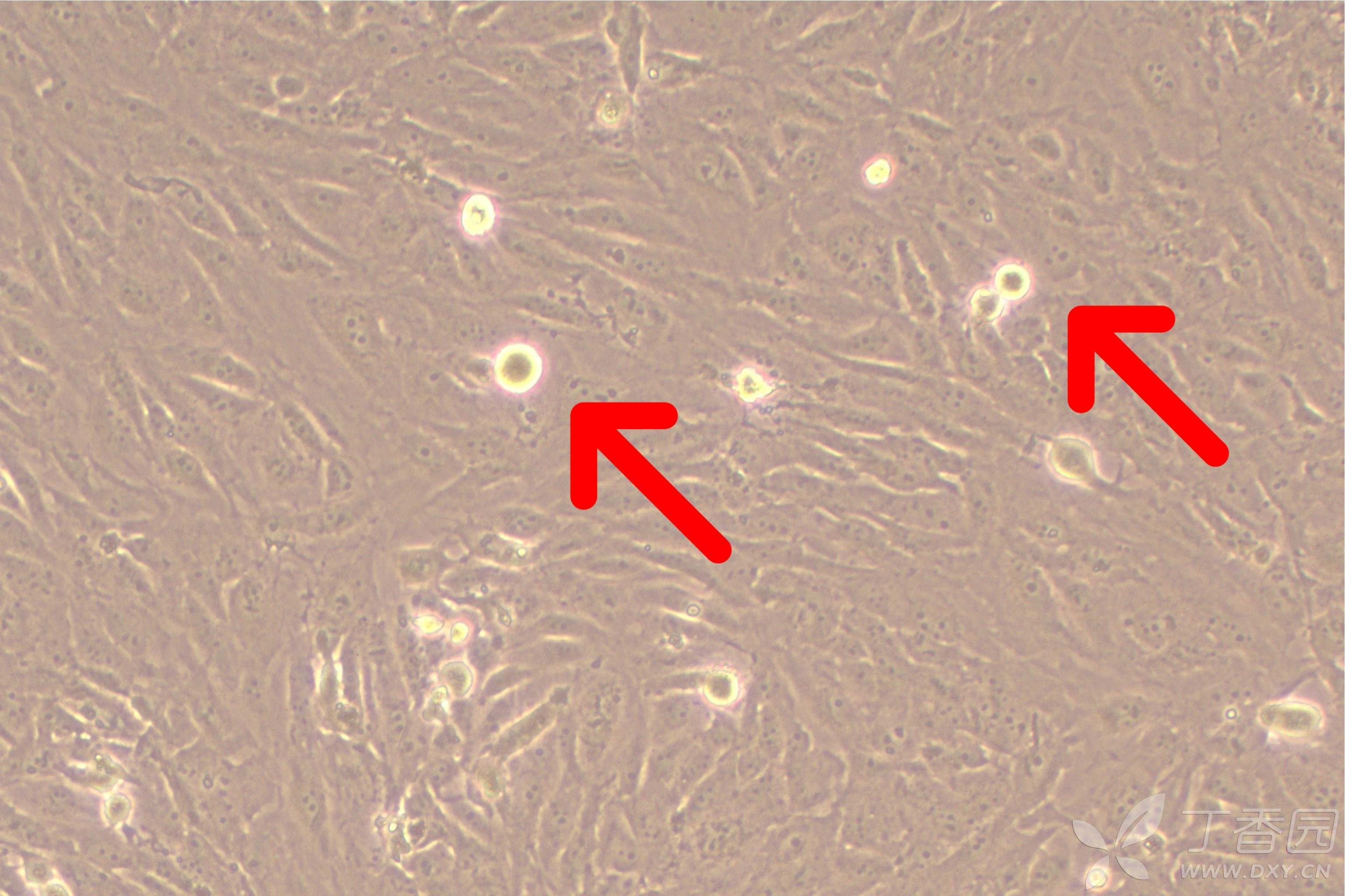 beas-2b细胞培养里出现亮亮的这个是什么