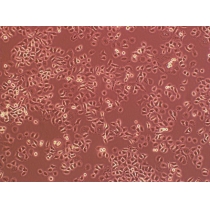 HME6（人黑色素瘤细胞）
