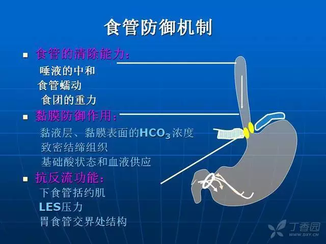 看完这篇文章，轻松掌握胃食管反流病！