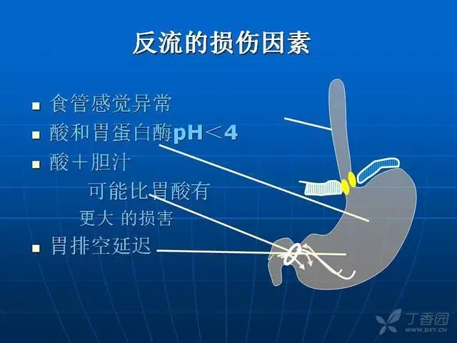 看完这篇文章，轻松掌握胃食管反流病！