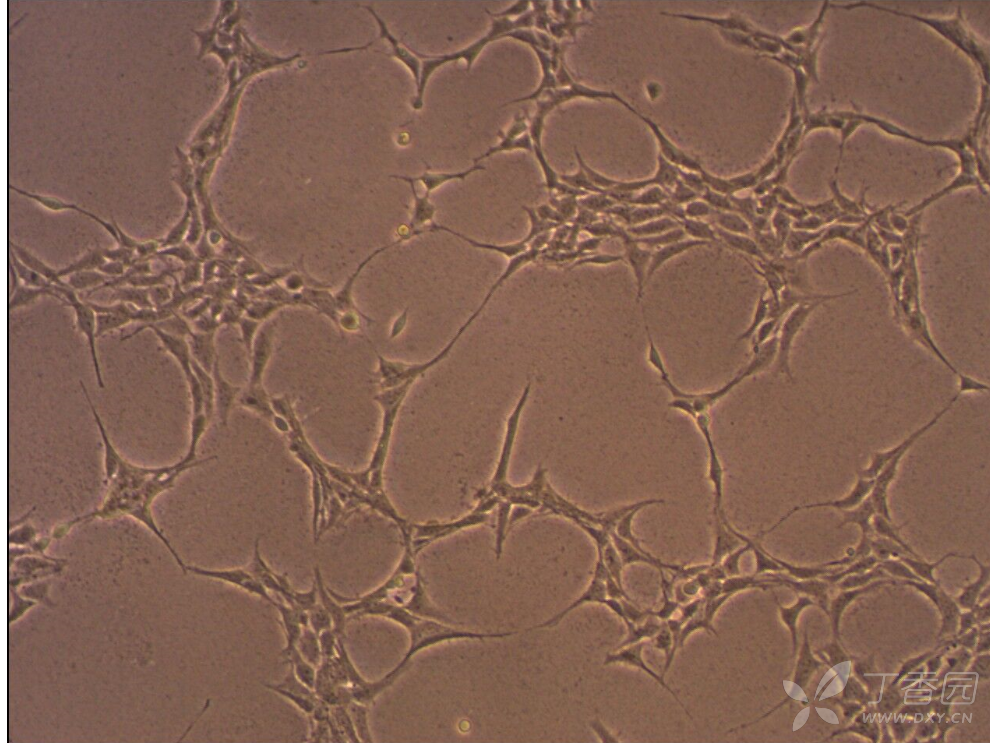 下图是低倍镜下黑胶虫污染细胞,培养液不浑浊,细胞生长缓慢 2019-02