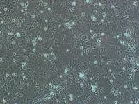 SMC-1（人胸膜瘤细胞）